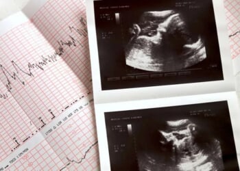 After 4 months on life support, Georgia woman delivers 1-pound baby boy