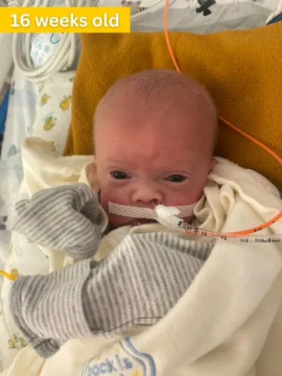 Nash Keen at 16 weeks old. Credit: Photo courtesy of University of Iowa Health Care