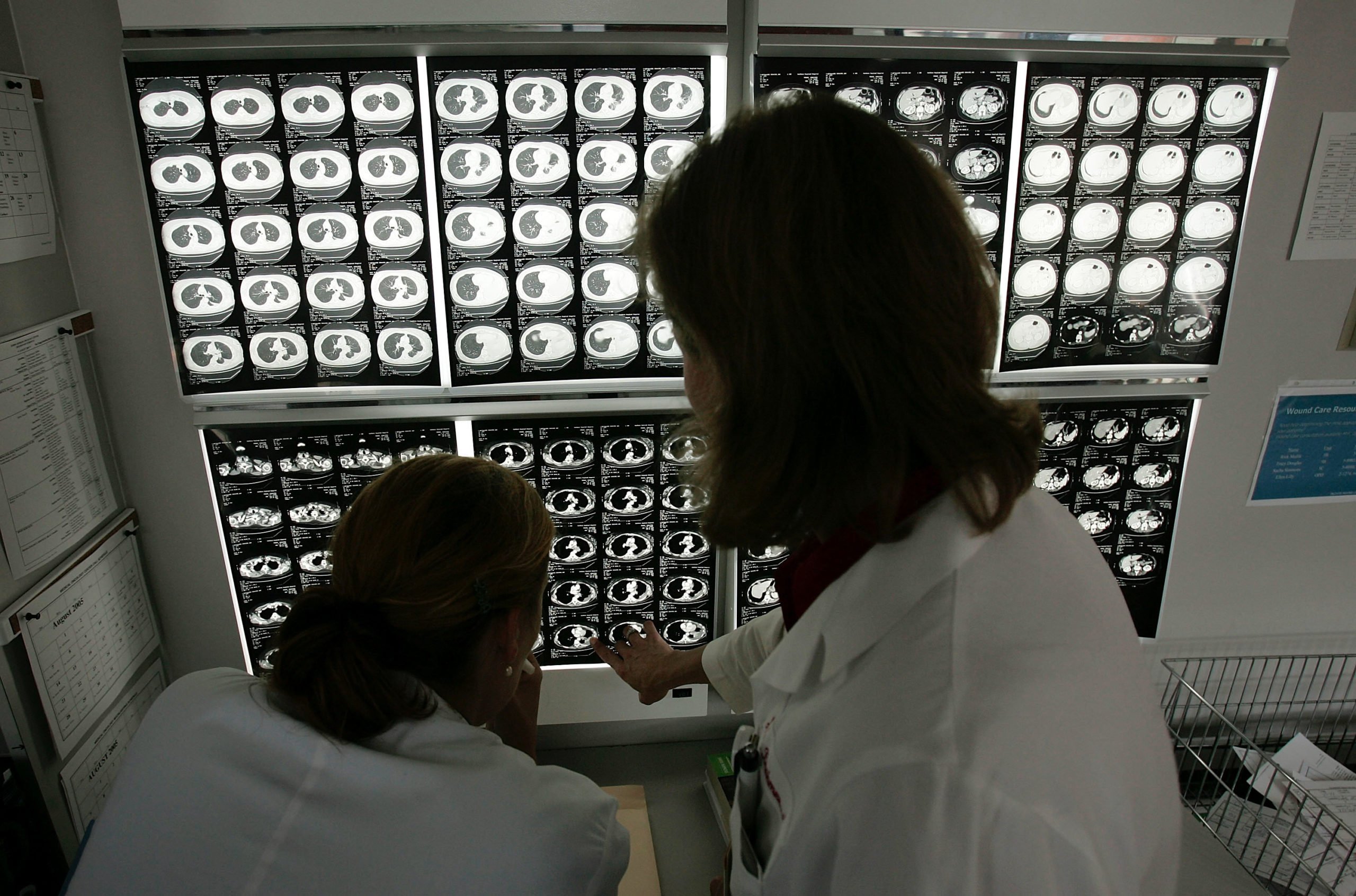 BALTIMORE - AUGUST 15: Dr. Julie Brahmer (R) and Katie Thornton review PET scans of a patient being treated at the Kimmel Comprehensive Cancer Center at Johns Hopkins August 15, 2005 in Baltimore, Maryland. Since its inception in 1973, the Sidney Kimmel Comprehensive Cancer Center at Johns Hopkins has been dedicated to better understanding human cancers and finding more effective treatments. (Photo by Win McNamee/Getty Images)