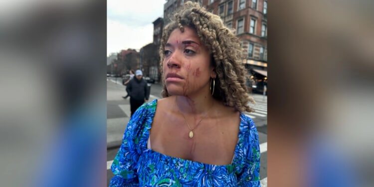 New York prosecutor drops charges against suspect in bloody assault on pro-life advocate