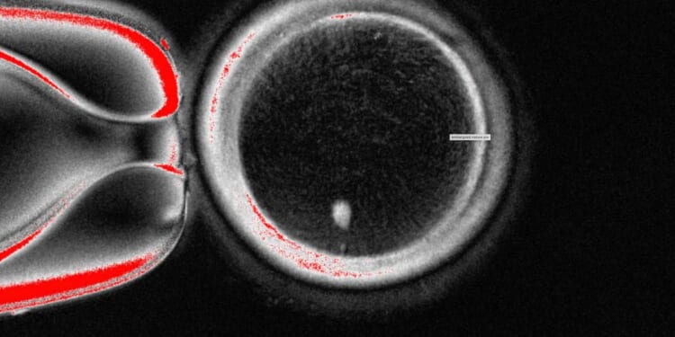 Oregon researchers turn human skin cells into eggs -- but not yet usable ones