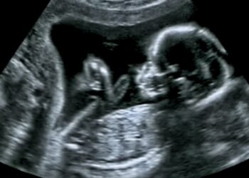 Boyfriend Named As Kentucky Student Faces Charges In Her Baby's Death [WATCH]