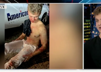 ‘A Broken Nose And A Concussion’: DOGE’s ‘Big Balls’ Recounts Brutal Beating To Save Friend