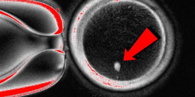 Image: Associated Press