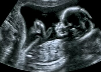 Gavin Newsom 'Invests' Millions to Keep Killing the Unborn at Planned Parenthood [WATCH]