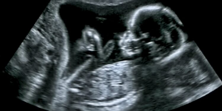 Gavin Newsom 'Invests' Millions to Keep Killing the Unborn at Planned Parenthood [WATCH]