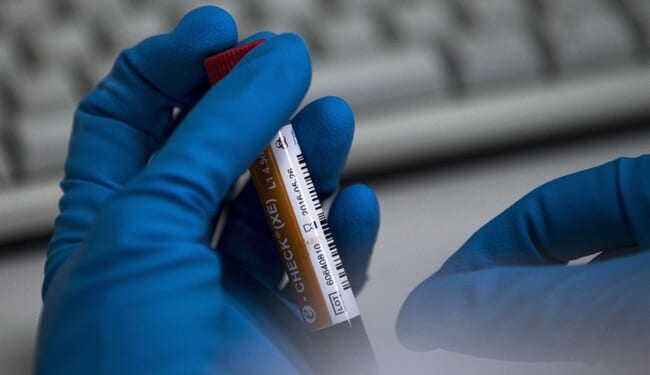 Project Lincoln Guy Assumes Breast Cancer Doesn’t Affect Trump Voters Due to Funding Cuts – Twitchy