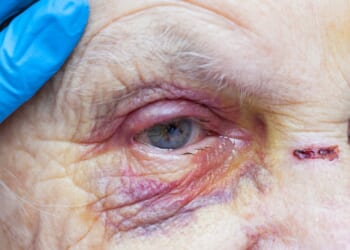 Florida Woman Charged With Murder After Reportedly Suffocating Parkinson’s-Stricken Mother