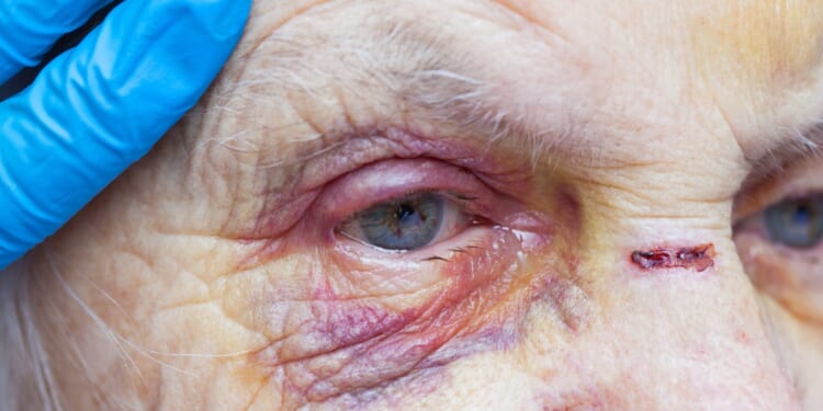 Florida Woman Charged With Murder After Reportedly Suffocating Parkinson’s-Stricken Mother