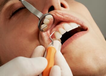 Lachlan Bruce: Why dental reform must be a Conservative priority