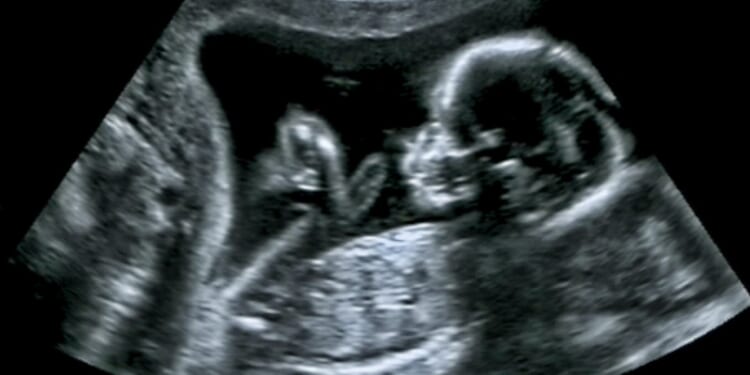 Ohio Doctor Charged With 6 Felonies Over Secret Abortion Drugs Given to Girlfriend