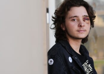 Federal agent fires projectile from close range, injuring demonstrator during California protest