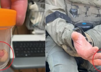 Anti-ICE Rioter Bites Federal Officer’s Finger Off During Minneapolis Chaos