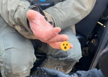 Rabid Anti-Ice Rioter Bites a Finger Off of a Federal Agent [WATCH]