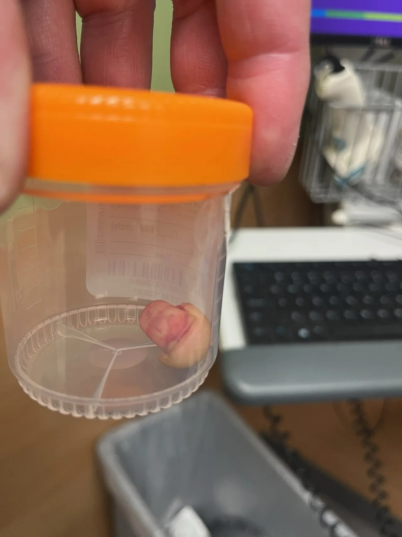 Severed finger of a Homeland Security Investigations officer. (X/TriciaOhio)