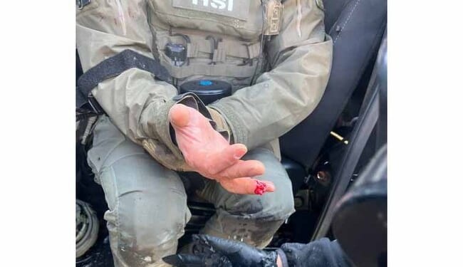 Rioter in Minneapolis Bites Off Finger of HSI Officer – Twitchy