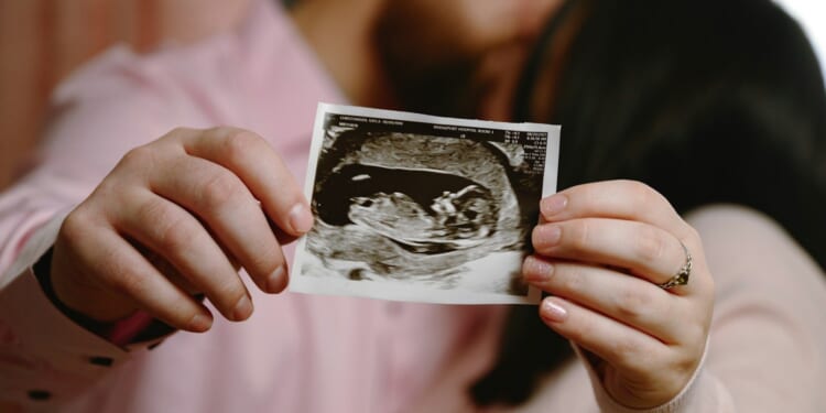 Phoebe Arslanagić-Little: If a womb transplant can help a woman have a baby, we should celebrate not criticise