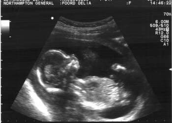 Charles Amos: Decriminalising abortion up to birth is too far even for pro-choicers